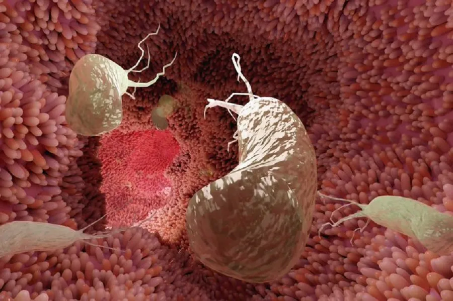 6 simptoma të kancerit të zorrës së trashë që shumë njerëz i injorojnë lehtësisht