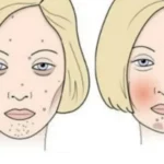 Zbuloni se cili ushqim po dëmton fytyrën tuaj: Njihuni me efektet e të ushqyerit