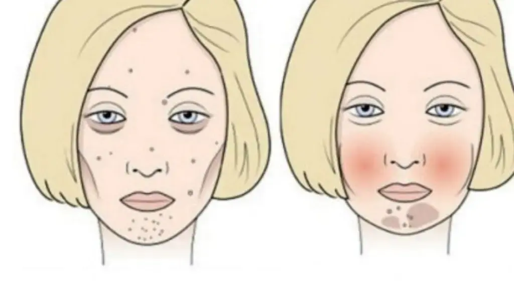 Zbuloni se cili ushqim po dëmton fytyrën tuaj: Njihuni me efektet e të ushqyerit