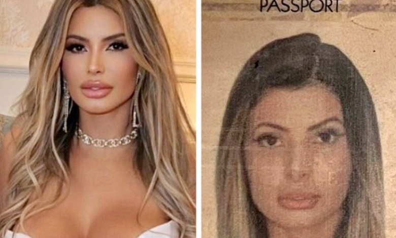 Harxhoi mbi 900 mijë euro në operacione plastike, modelja braziliane ndalohet në kufi pasi dogana nuk e njohu në pasaportë