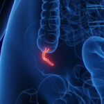 Ekspertët të habitur: Pse një lloj i rrallë kanceri po prek të rinjtë?