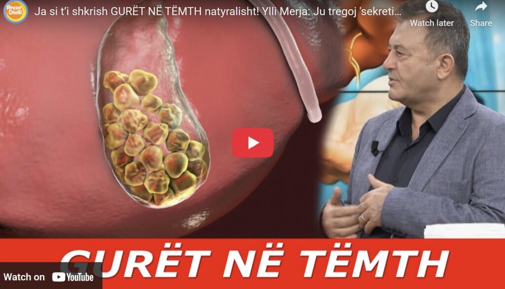 Kujdes mos i neglizhoni këto simptoma! 5 shenjat që tregojnë probleme me tëmthin / Ylli Merja tregon ‘sekretin’ natyral për gurët në tëmth
